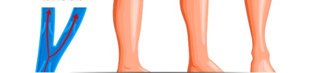 normal veins